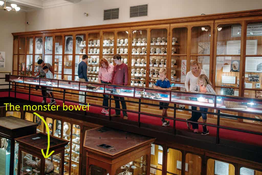 Rows and cabinets of macabre exhibits